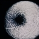 Solar Retinopathy / Familial Solar Retinopathy / Familial