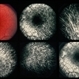 Fundus albipunctatus Fundus albipunctatus