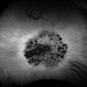 Mucopolysaccharidosis Type III (Sanfilippo syndrome) Mucopolysaccharidosis Type III (Sanfilippo syndrome)