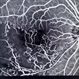 occlusion of retinal vein occlusion of retinal vein