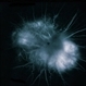 Combined Retinal / RPE Hamartoma Combined Retinal / RPE Hamartoma