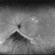 Retinitis Pigmentosa Retinitis Pigmentosa