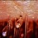 Lice in Lashes