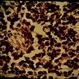 Retinoblastoma Retinoblastoma