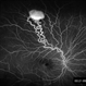 Retinal Hemangioblastoma Mid Phase FA Retinal Hemangioblastoma Mid Phase FA