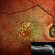 Dry Age Related Macular Degeneration Dry Age Related Macular Degeneration