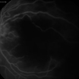 Macular Ischemia in Lupus Retinopathy Macular Ischemia in Lupus Retinopathy