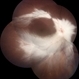 Myelinated Nerve Fibre (MNF) Myelinated Nerve Fibre (MNF)
