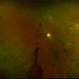 Proliferative Diabetic Retinopathy with Vitreous Hemorrhage Proliferative Diabetic Retinopathy with Vitreous Hemorrhage
