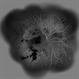 Acute Idiopathic Occlusive Retinal Vasculitis