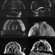 Age-Related Differences in the Structure of the Human Vitreous Body Age-Related Differences in the Structure of the Human Vitreous Body