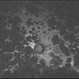 Extensive/ Heavy Focal/ PRP OS - FAF Extensive/ Heavy Focal/ PRP OS - FAF