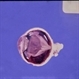 Gross Specimen Eye Ball