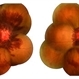 Anemic Retinopathy in a Young Female Anemic Retinopathy in a Young Female