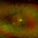 Retinitis Pigmentosa Retinitis Pigmentosa