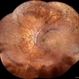 Retinopathy of Prematurity