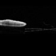 Plateau Iris from Aqueous Misdirection Plateau Iris from Aqueous Misdirection