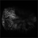 Familial Exudative Vitreoretinopathy with Cataract