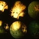 Choroidal Atrophy Choroidal Atrophy