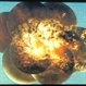 Morning Glory Optic Nerve Malformation / Perhaps Associated With Drusen / Old Resolved Retinal Detachment With Pigmentation Morning Glory Optic Nerve Malformation / Perhaps Associated With Drusen / Old Resolved Retinal Detachment With Pigmentation