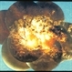 Morning Glory Optic Nerve Malformation / Perhaps Associated With Drusen / Old Resolved Retinal Detachment With Pigmentation Morning Glory Optic Nerve Malformation / Perhaps Associated With Drusen / Old Resolved Retinal Detachment With Pigmentation