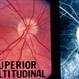 Optic Nerve Head Drusen Optic Nerve Head Drusen