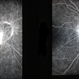 Anterior Ischemic Optic Neruopathy Anterior Ischemic Optic Neruopathy