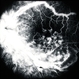 Partial Central Retinal Vein Occlusion V Papillophlebitis OD Partial Central Retinal Vein Occlusion V Papillophlebitis OD