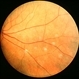 Trifurcation Vein