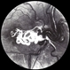 Racemose Hemangioma Racemose Hemangioma