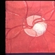 Optic Nerve Malformation Optic Nerve Malformation