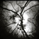 Optic disc Optic disc