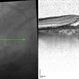 Bulls eye retinopathy OCT LE Bulls eye retinopathy OCT LE