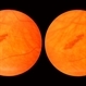 Lattice Lesion Lattice Lesion