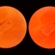 Inactive Toxoplasmosis Inactive Toxoplasmosis