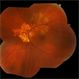 Serpiginous Serpiginous