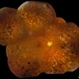 Diabetic Retinopathy