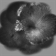 FEVR+ Optic Disc Hypoplasia FEVR+ Optic Disc Hypoplasia