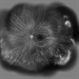 Familial Exudative Vitreoretinopathy (FEVR) Familial Exudative Vitreoretinopathy (FEVR)