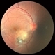 Toxoplasmosis Slide 2 Toxoplasmosis Slide 2