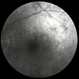 Birdshot Chorioretinopathy  FA Mid Phase Left Eye Birdshot Chorioretinopathy  FA Mid Phase Left Eye