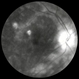 Birdshot Chorioretinopathy FA with Optic Nerve Leakage Right Eye Birdshot Chorioretinopathy FA with Optic Nerve Leakage Right Eye