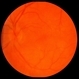 Syphilitic Optic Neuritis Acute Syphilitic Optic Neuritis Acute