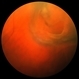 Retinal Tear Retinal Tear