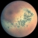 Sector Retinitis Pigmentosa Sector Retinitis Pigmentosa