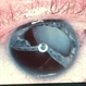 Traumatic Lens Dislocation Traumatic Lens Dislocation