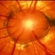 Morning Glory of Disc