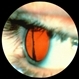 Avulsed Vitreous Base