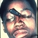 Knife Through Eye Knife Through Eye
