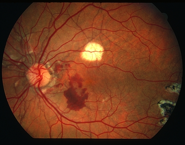 image full;max$643,0